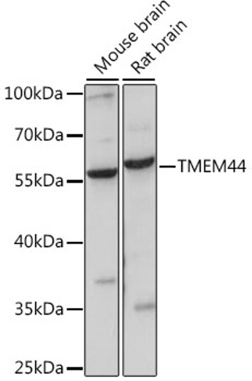 Western blot analysis of extracts of various cell lines, using TMEM44 antibody (16-326) at 1:1000 dilution.<br/>Secondary antibody: HRP Goat Anti-Rabbit IgG (H+L) at 1:10000 dilution.<br/>Lysates/proteins: 25ug per lane.<br/>Blocking buffer: 3% nonfat dry milk in TBST.<br/>Detection: ECL Basic Kit.<br/>Exposure time: 30s.