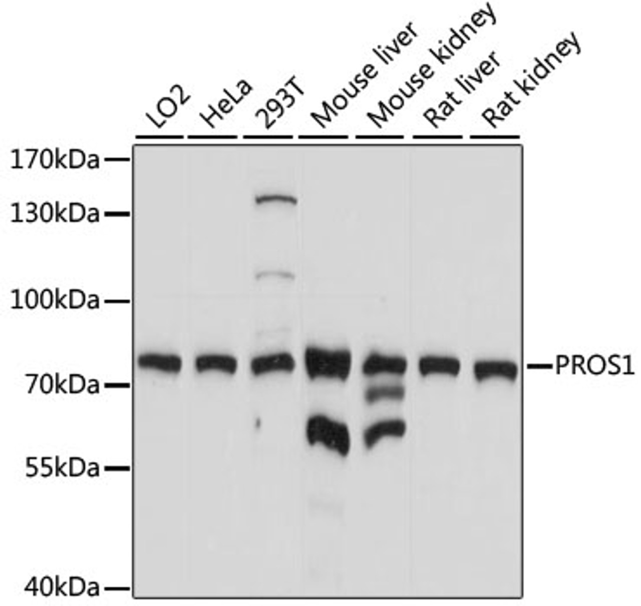 Western blot analysis of extracts of various cell lines, using PROS1 antibody (16-337) at 1:1000 dilution.<br/>Secondary antibody: HRP Goat Anti-Rabbit IgG (H+L) at 1:10000 dilution.<br/>Lysates/proteins: 25ug per lane.<br/>Blocking buffer: 3% nonfat dry milk in TBST.<br/>Detection: ECL Basic Kit.<br/>Exposure time: 5s.