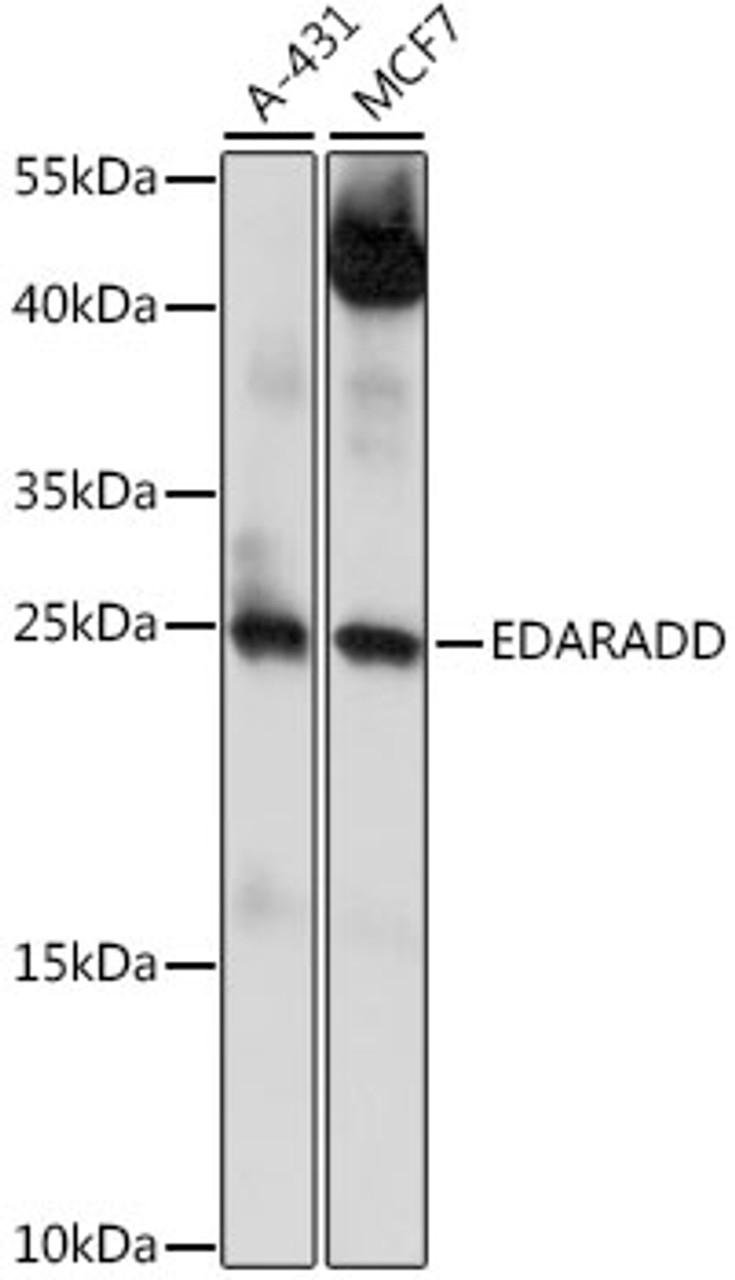 Western blot analysis of extracts of various cell lines, using EDARADD antibody (16-338) at 1:1000 dilution.<br/>Secondary antibody: HRP Goat Anti-Rabbit IgG (H+L) at 1:10000 dilution.<br/>Lysates/proteins: 25ug per lane.<br/>Blocking buffer: 3% nonfat dry milk in TBST.<br/>Detection: ECL Basic Kit.<br/>Exposure time: 60s.