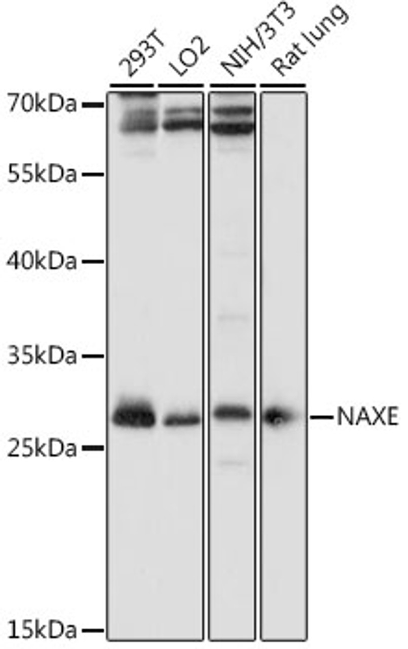 Western blot analysis of extracts of various cell lines, using NAXE antibody (16-340) at 1:1000 dilution.<br/>Secondary antibody: HRP Goat Anti-Rabbit IgG (H+L) at 1:10000 dilution.<br/>Lysates/proteins: 25ug per lane.<br/>Blocking buffer: 3% nonfat dry milk in TBST.<br/>Detection: ECL Basic Kit.<br/>Exposure time: 10s.