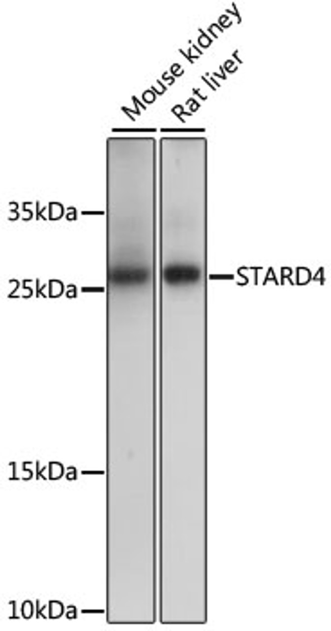 Western blot analysis of extracts of various cell lines, using STARD4 antibody (16-342) at 1000 dilution.<br/>Secondary antibody: HRP Goat Anti-Rabbit IgG (H+L) at 1:10000 dilution.<br/>Lysates/proteins: 25ug per lane.<br/>Blocking buffer: 3% nonfat dry milk in TBST.<br/>Detection: ECL Basic Kit.<br/>Exposure time: 10s.