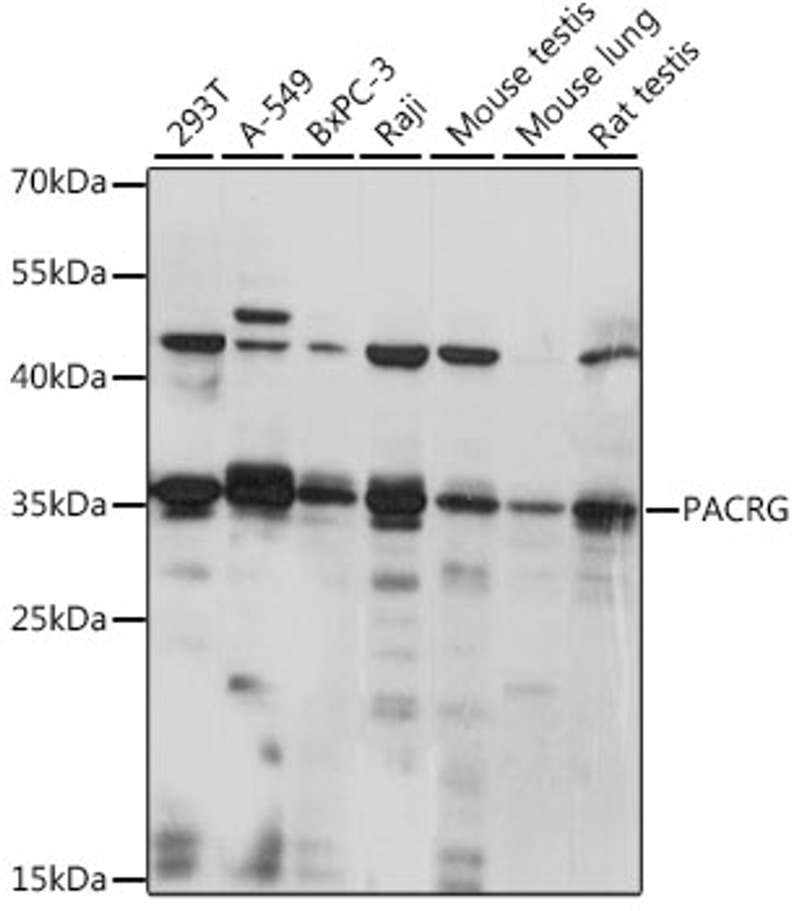 Western blot analysis of extracts of various cell lines, using PACRG antibody (16-343) at 1:1000 dilution.<br/>Secondary antibody: HRP Goat Anti-Rabbit IgG (H+L) at 1:10000 dilution.<br/>Lysates/proteins: 25ug per lane.<br/>Blocking buffer: 3% nonfat dry milk in TBST.<br/>Detection: ECL Basic Kit.<br/>Exposure time: 10s.