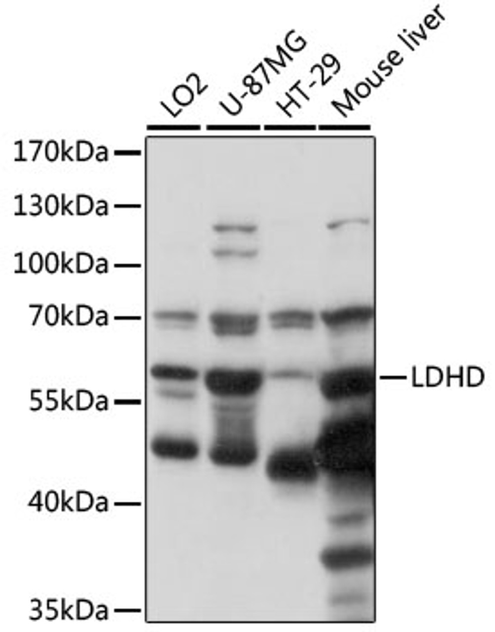 Western blot analysis of extracts of various cell lines, using LDHD antibody (16-349) at 1000 dilution.<br/>Secondary antibody: HRP Goat Anti-Rabbit IgG (H+L) at 1:10000 dilution.<br/>Lysates/proteins: 25ug per lane.<br/>Blocking buffer: 3% nonfat dry milk in TBST.<br/>Detection: ECL Basic Kit.<br/>Exposure time: 5s.