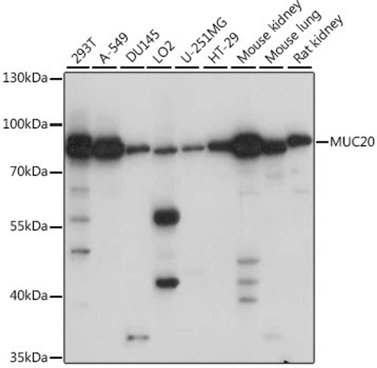 Western blot analysis of extracts of various cell lines, using MUC20 antibody (16-352) at 1:1000 dilution.<br/>Secondary antibody: HRP Goat Anti-Rabbit IgG (H+L) at 1:10000 dilution.<br/>Lysates/proteins: 25ug per lane.<br/>Blocking buffer: 3% nonfat dry milk in TBST.<br/>Detection: ECL Basic Kit.<br/>Exposure time: 1s.