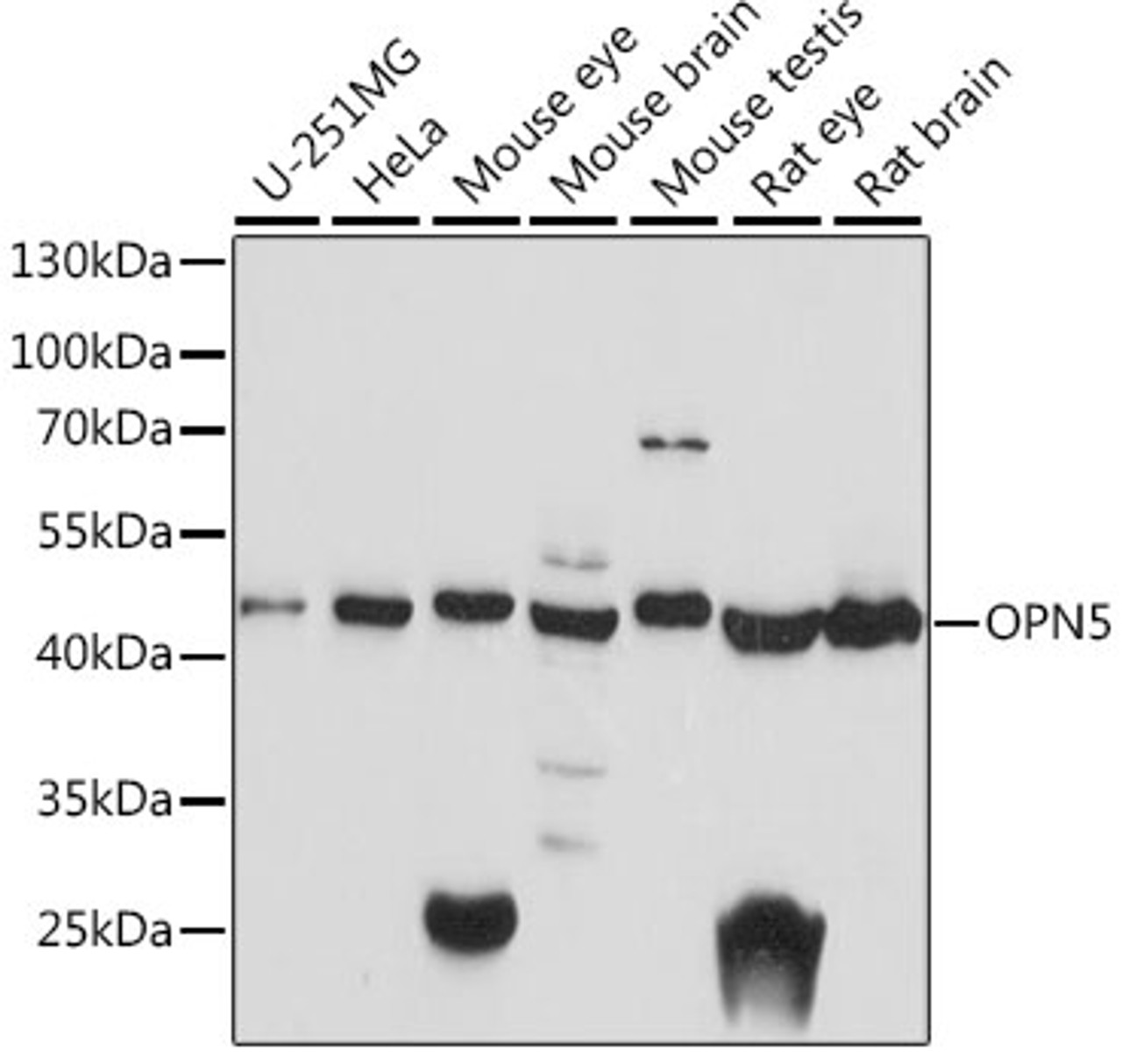 Western blot analysis of extracts of various cell lines, using OPN5 antibody (16-355) at 1:1000 dilution.<br/>Secondary antibody: HRP Goat Anti-Rabbit IgG (H+L) at 1:10000 dilution.<br/>Lysates/proteins: 25ug per lane.<br/>Blocking buffer: 3% nonfat dry milk in TBST.<br/>Detection: ECL Basic Kit.<br/>Exposure time: 30s.