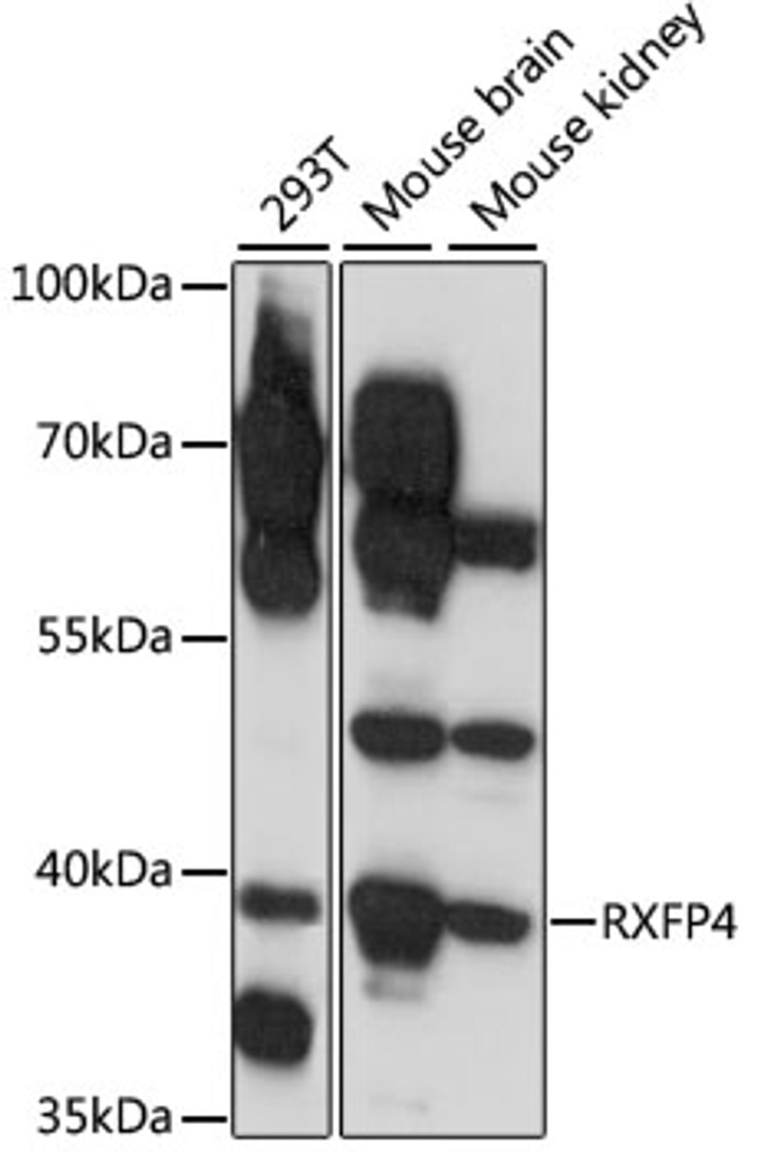 Western blot analysis of extracts of various cell lines, using RXFP4 antibody (16-357) at 1:1000 dilution.<br/>Secondary antibody: HRP Goat Anti-Rabbit IgG (H+L) at 1:10000 dilution.<br/>Lysates/proteins: 25ug per lane.<br/>Blocking buffer: 3% nonfat dry milk in TBST.<br/>Detection: ECL Enhanced Kit.<br/>Exposure time: 1s.