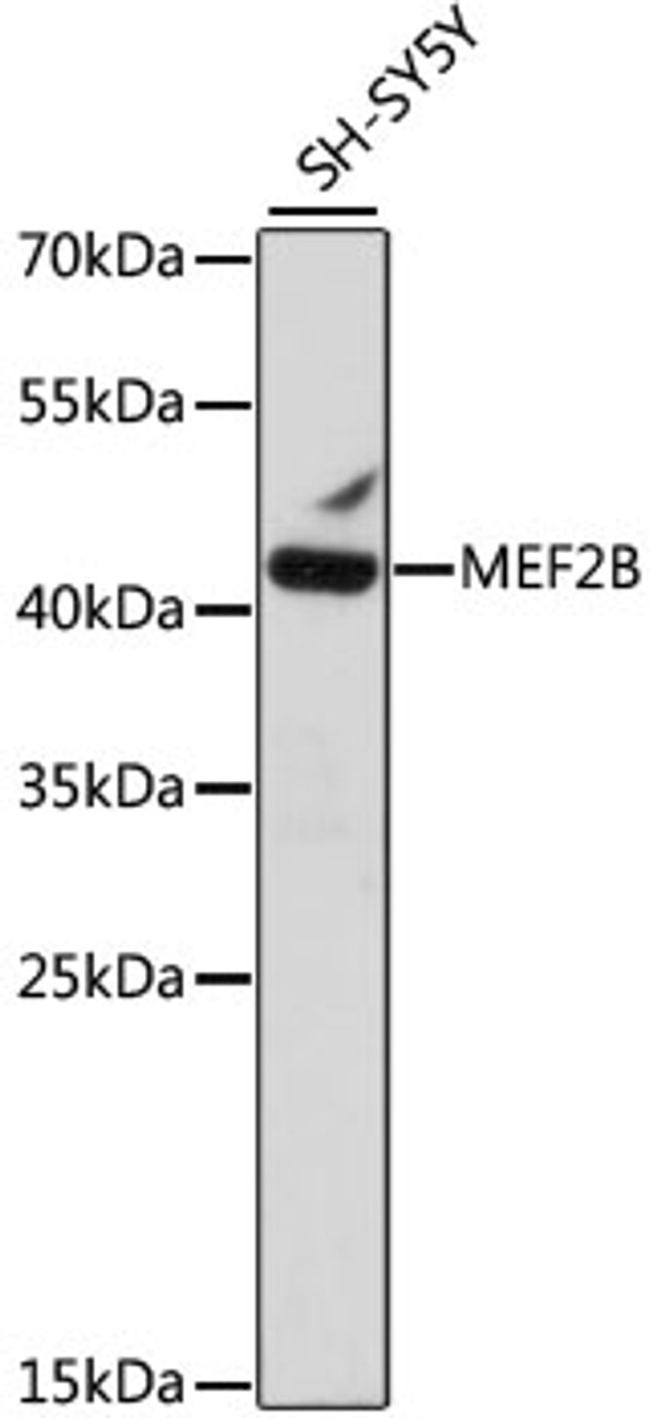 Western blot analysis of extracts of SH-SY5Y cells, using MEF2B antibody (16-364) at 1:1000 dilution.<br/>Secondary antibody: HRP Goat Anti-Rabbit IgG (H+L) at 1:10000 dilution.<br/>Lysates/proteins: 25ug per lane.<br/>Blocking buffer: 3% nonfat dry milk in TBST.<br/>Detection: ECL Basic Kit.<br/>Exposure time: 3min.