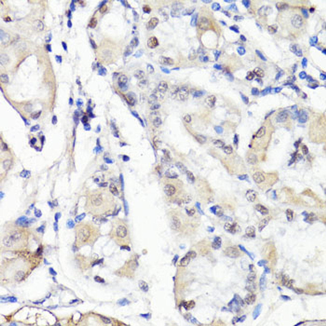 Immunohistochemistry of paraffin-embedded human stomach using TBX20 antibody (16-369) at dilution of 1:100 (40x lens) .