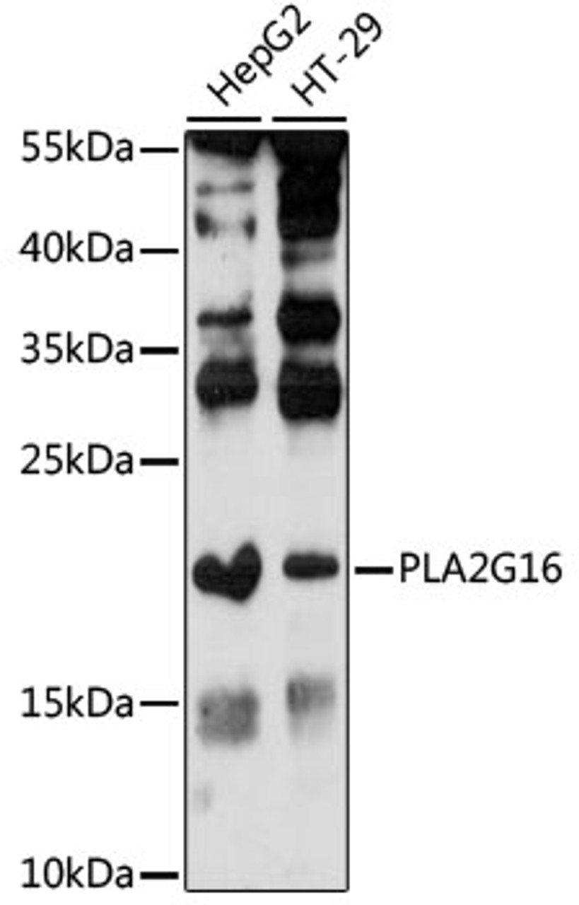 Western blot analysis of extracts of various cell lines, using PLA2G16 antibody (16-377) at 1:1000 dilution.<br/>Secondary antibody: HRP Goat Anti-Rabbit IgG (H+L) at 1:10000 dilution.<br/>Lysates/proteins: 25ug per lane.<br/>Blocking buffer: 3% nonfat dry milk in TBST.<br/>Detection: ECL Enhanced Kit.<br/>Exposure time: 90s.