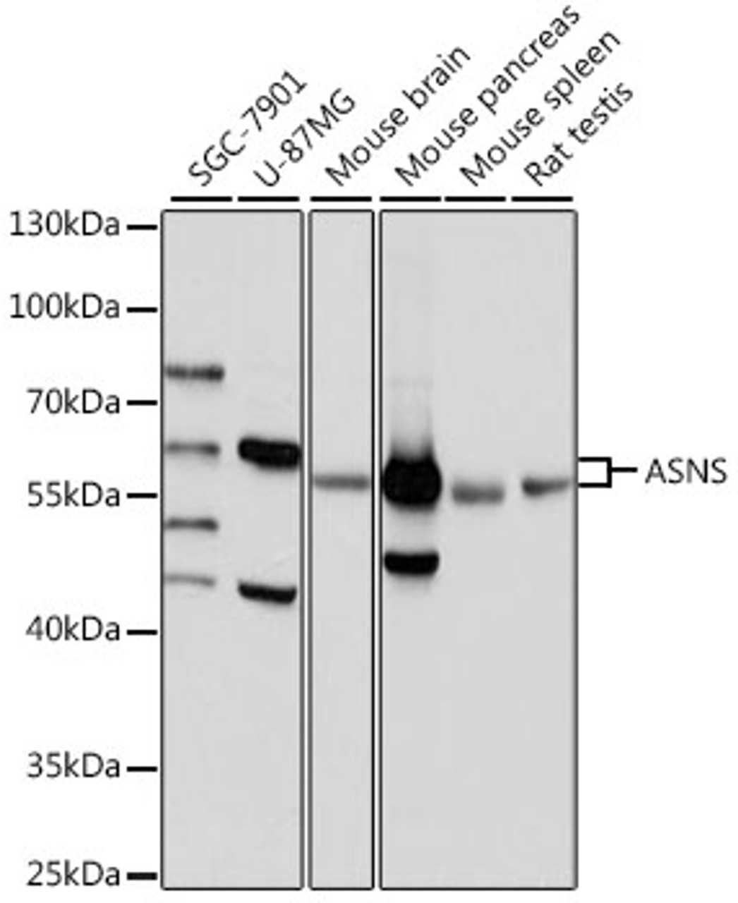 Western blot analysis of extracts of various cell lines, using ASNS antibody (16-388) at 1:1000 dilution.<br/>Secondary antibody: HRP Goat Anti-Rabbit IgG (H+L) at 1:10000 dilution.<br/>Lysates/proteins: 25ug per lane.<br/>Blocking buffer: 3% nonfat dry milk in TBST.<br/>Detection: ECL Basic Kit.<br/>Exposure time: 3s.