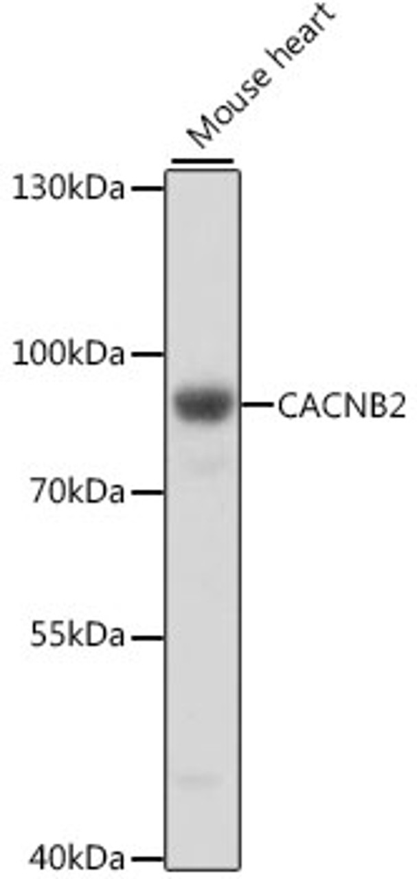Western blot analysis of extracts of mouse heart, using CACNB2 antibody (16-389) at 1:1000 dilution.<br/>Secondary antibody: HRP Goat Anti-Rabbit IgG (H+L) at 1:10000 dilution.<br/>Lysates/proteins: 25ug per lane.<br/>Blocking buffer: 3% nonfat dry milk in TBST.<br/>Detection: ECL Basic Kit.<br/>Exposure time: 15s.