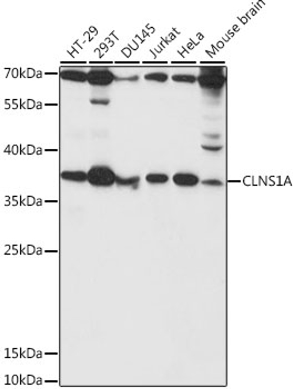 Western blot analysis of extracts of various cell lines, using CLNS1A antibody (16-392) at 1:1000 dilution.<br/>Secondary antibody: HRP Goat Anti-Rabbit IgG (H+L) at 1:10000 dilution.<br/>Lysates/proteins: 25ug per lane.<br/>Blocking buffer: 3% nonfat dry milk in TBST.<br/>Detection: ECL Basic Kit.<br/>Exposure time: 5s.