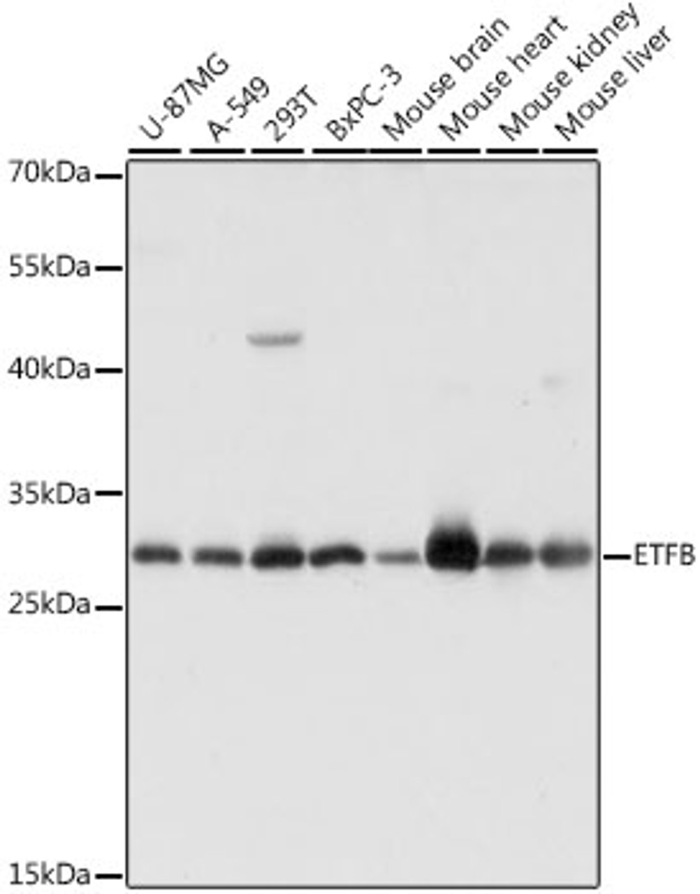Western blot analysis of extracts of various cell lines, using ETFB antibody (16-393) at 1:1000 dilution.<br/>Secondary antibody: HRP Goat Anti-Rabbit IgG (H+L) at 1:10000 dilution.<br/>Lysates/proteins: 25ug per lane.<br/>Blocking buffer: 3% nonfat dry milk in TBST.<br/>Detection: ECL Basic Kit.<br/>Exposure time: 5s.