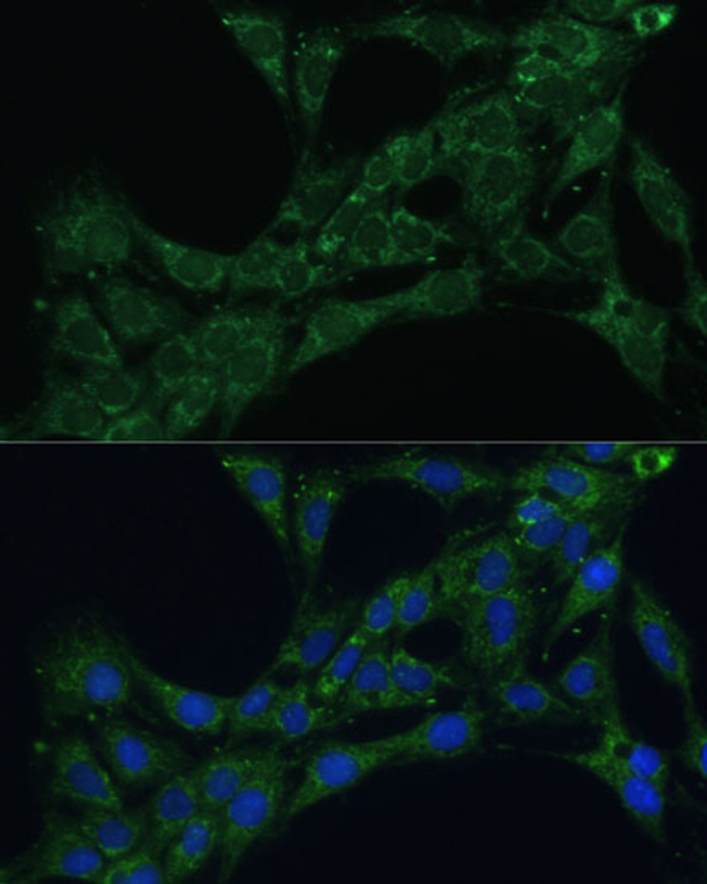 Immunofluorescence analysis of C6 cells using ETFB Polyclonal Antibody (16-393) at dilution of 1:100 (40x lens) . Blue: DAPI for nuclear staining.