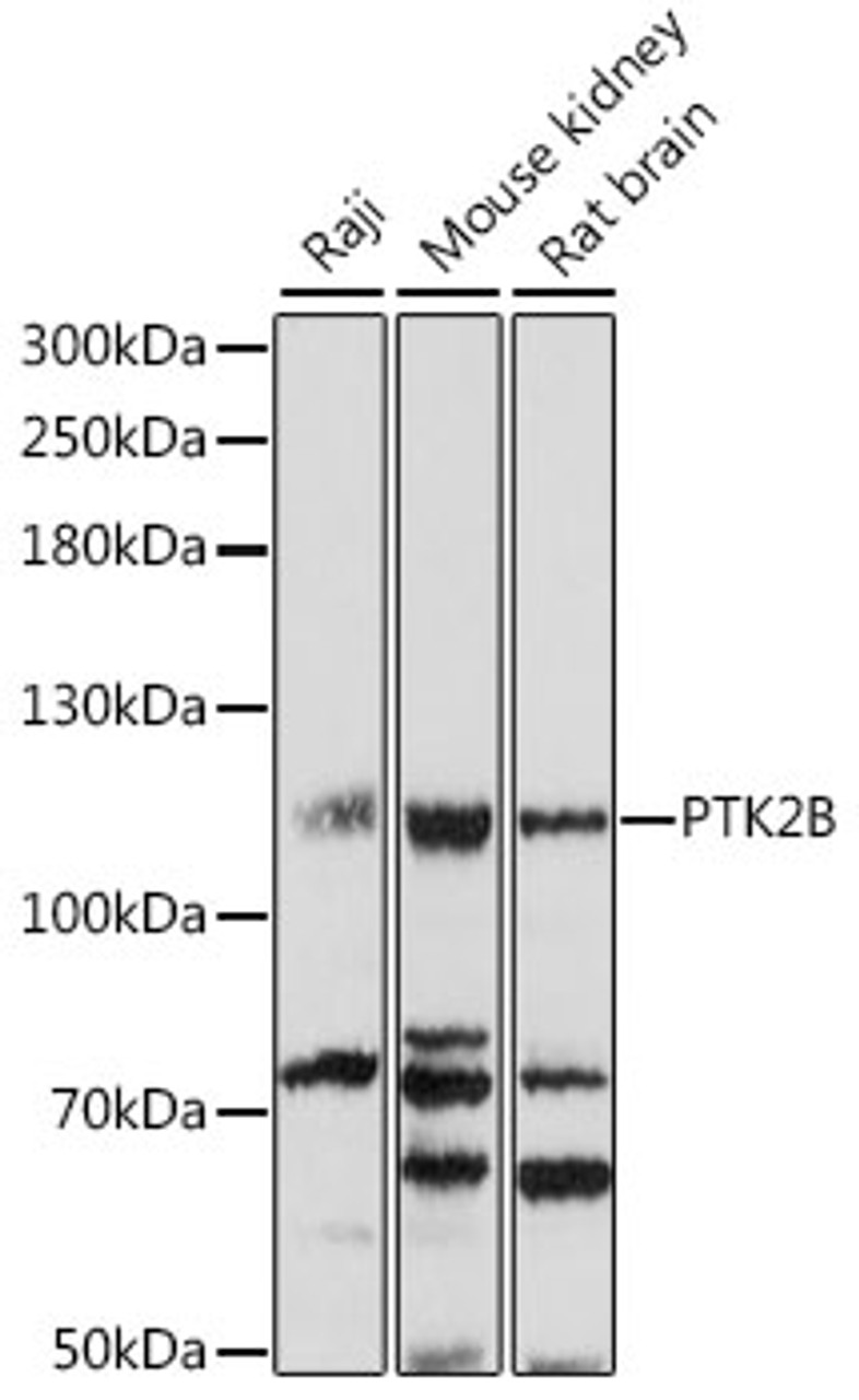 Western blot analysis of extracts of various cell lines, using PTK2B antibody (16-395) at 1:1000 dilution.<br/>Secondary antibody: HRP Goat Anti-Rabbit IgG (H+L) at 1:10000 dilution.<br/>Lysates/proteins: 25ug per lane.<br/>Blocking buffer: 3% nonfat dry milk in TBST.<br/>Detection: ECL Basic Kit.<br/>Exposure time: 30s.