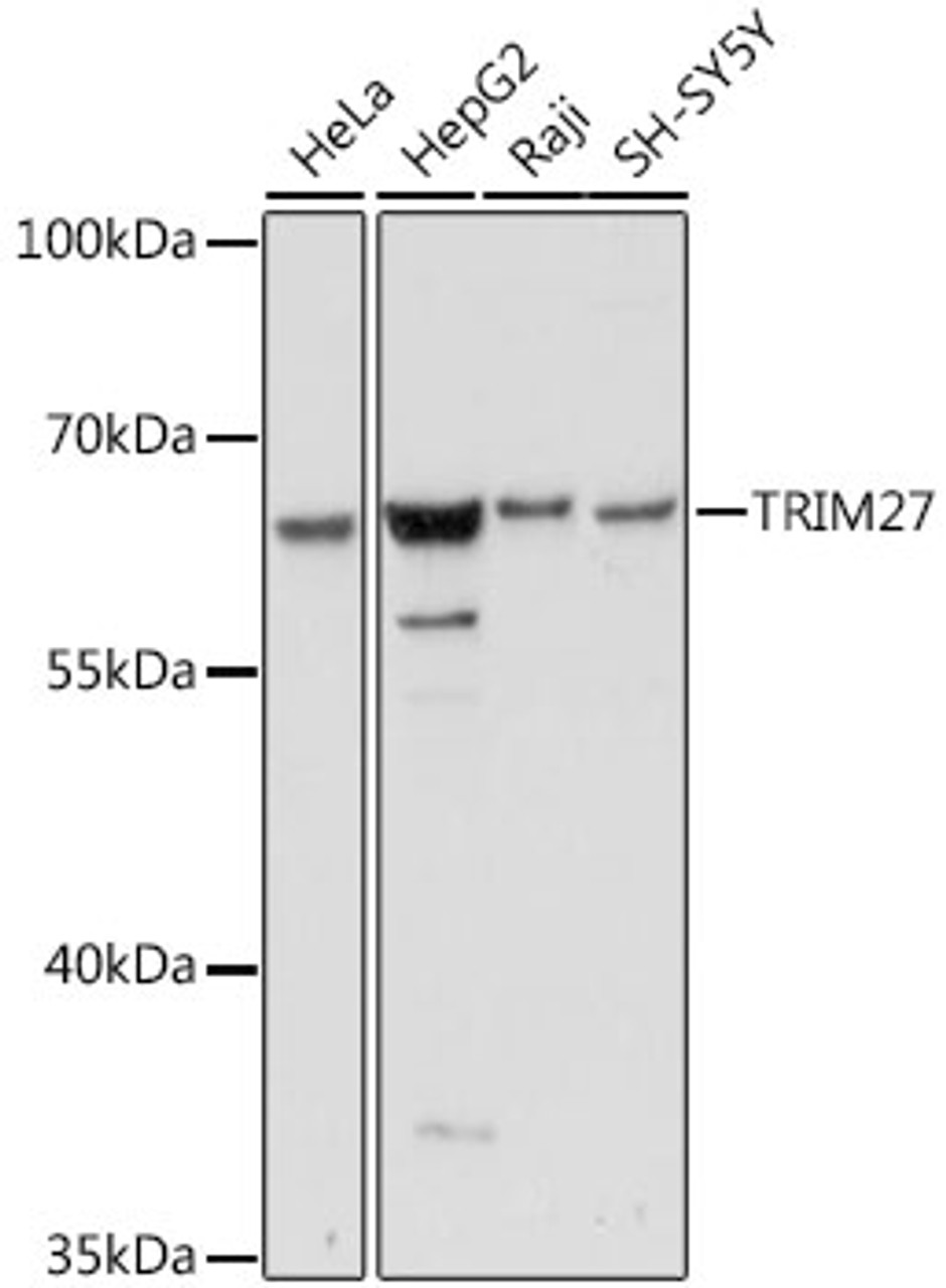 Western blot analysis of extracts of various cell lines, using TRIM27 antibody (16-408) at 1:1000 dilution.<br/>Secondary antibody: HRP Goat Anti-Rabbit IgG (H+L) at 1:10000 dilution.<br/>Lysates/proteins: 25ug per lane.<br/>Blocking buffer: 3% nonfat dry milk in TBST.<br/>Detection: ECL Basic Kit.<br/>Exposure time: 10s.