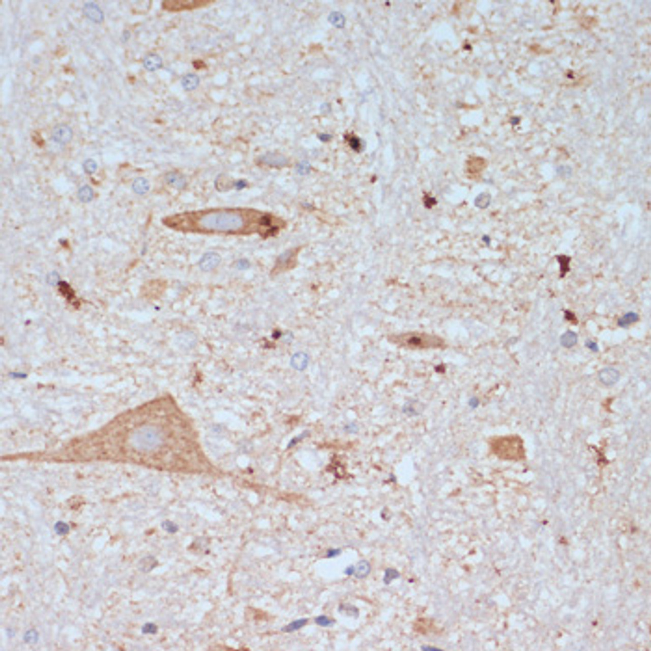 Immunohistochemistry of paraffin-embedded rat brain using SLC18A3 antibody (16-409) at dilution of 1:200 (40x lens) .