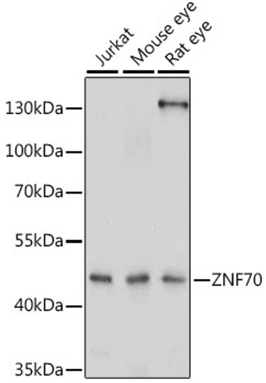 Western blot analysis of extracts of various cell lines, using ZNF70 antibody (16-413) at 1:1000 dilution.<br/>Secondary antibody: HRP Goat Anti-Rabbit IgG (H+L) at 1:10000 dilution.<br/>Lysates/proteins: 25ug per lane.<br/>Blocking buffer: 3% nonfat dry milk in TBST.<br/>Detection: ECL Enhanced Kit.<br/>Exposure time: 10s.