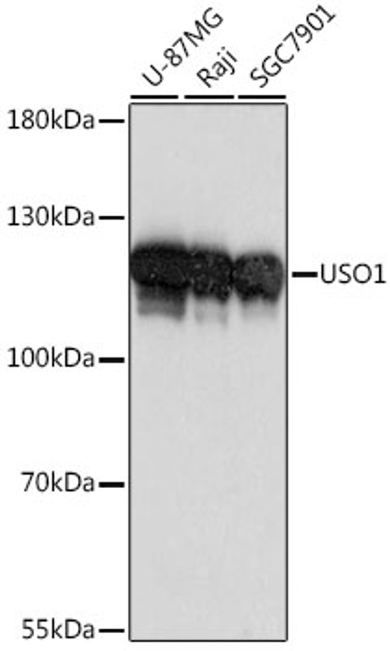 Western blot analysis of extracts of various cell lines, using USO1 antibody (16-417) at 1:1000 dilution.<br/>Secondary antibody: HRP Goat Anti-Rabbit IgG (H+L) at 1:10000 dilution.<br/>Lysates/proteins: 25ug per lane.<br/>Blocking buffer: 3% nonfat dry milk in TBST.<br/>Detection: ECL Basic Kit.<br/>Exposure time: 1s.