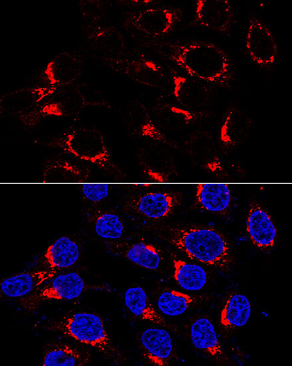 Immunofluorescence analysis of HeLa cells using USO1 antibody (16-417) at dilution of 1:200 (60x lens) . Blue: DAPI for nuclear staining.