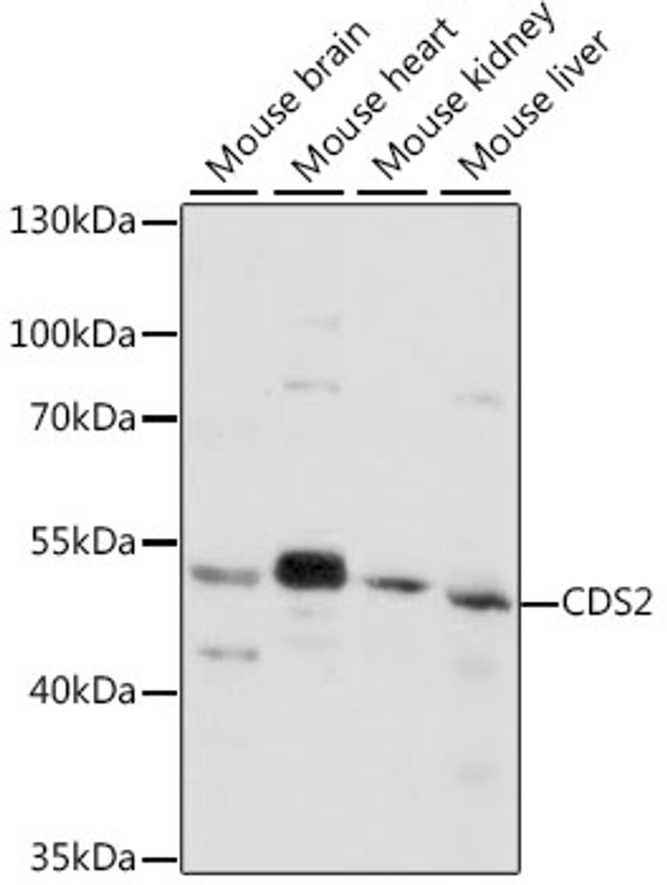 Western blot analysis of extracts of various cell lines, using CDS2 antibody (16-419) at 1:1000 dilution.<br/>Secondary antibody: HRP Goat Anti-Rabbit IgG (H+L) at 1:10000 dilution.<br/>Lysates/proteins: 25ug per lane.<br/>Blocking buffer: 3% nonfat dry milk in TBST.<br/>Detection: ECL Basic Kit.<br/>Exposure time: 30s.
