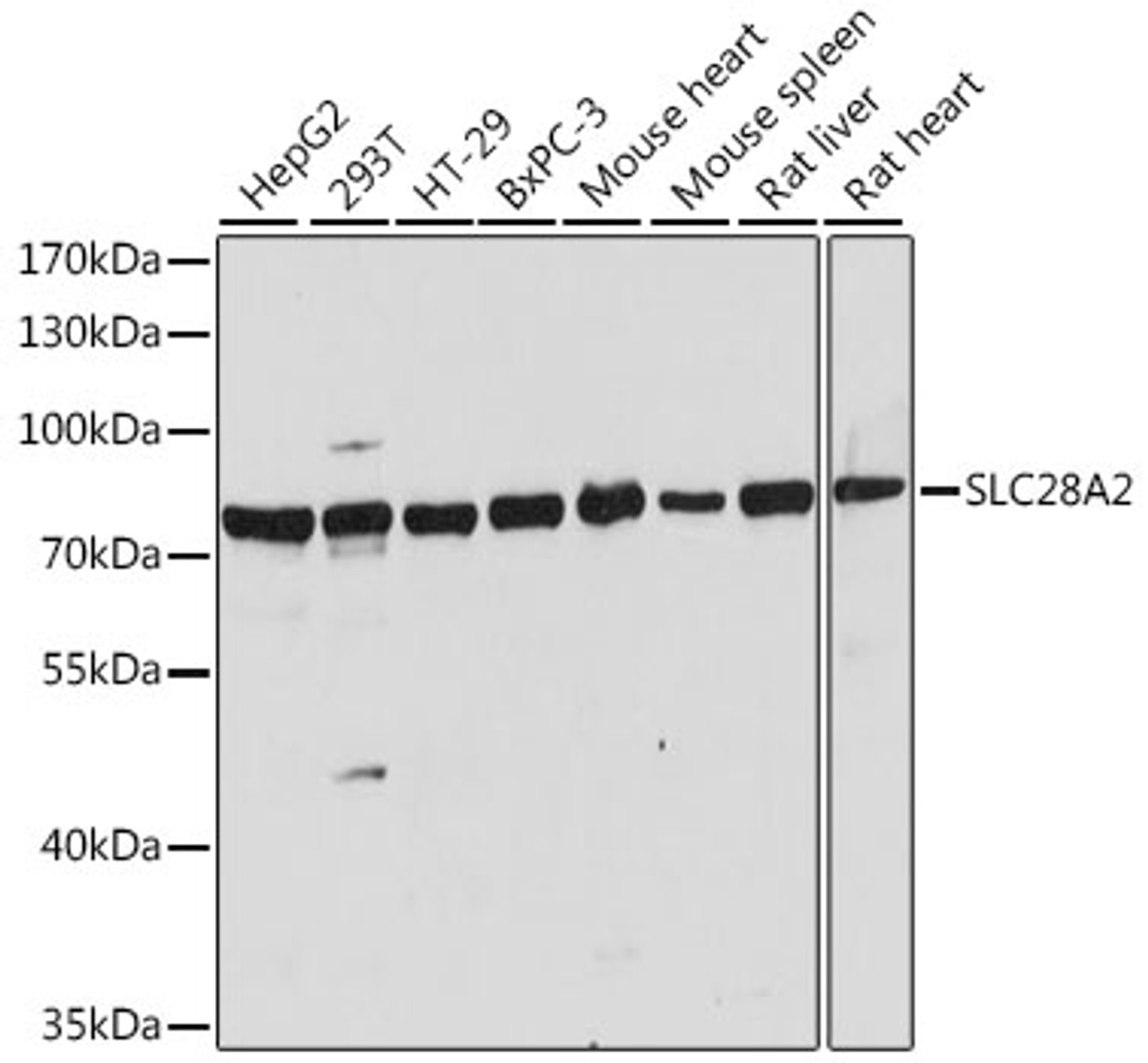 Western blot analysis of extracts of various cell lines, using SLC28A2 antibody (16-422) at 1:1000 dilution.<br/>Secondary antibody: HRP Goat Anti-Rabbit IgG (H+L) at 1:10000 dilution.<br/>Lysates/proteins: 25ug per lane.<br/>Blocking buffer: 3% nonfat dry milk in TBST.<br/>Detection: ECL Basic Kit.<br/>Exposure time: 5s.