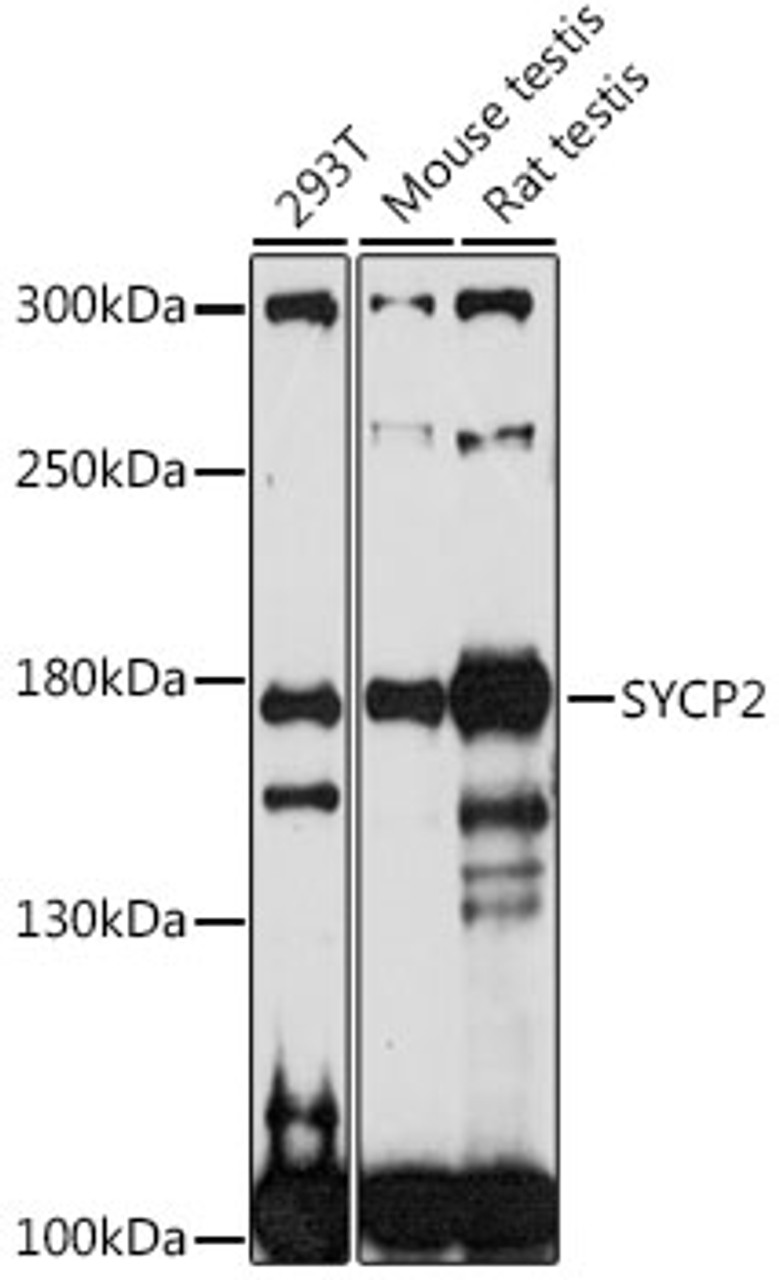 Western blot analysis of extracts of various cell lines, using SYCP2 antibody (16-427) at 1:1000 dilution.<br/>Secondary antibody: HRP Goat Anti-Rabbit IgG (H+L) at 1:10000 dilution.<br/>Lysates/proteins: 25ug per lane.<br/>Blocking buffer: 3% nonfat dry milk in TBST.<br/>Detection: ECL Basic Kit.<br/>Exposure time: 90s.