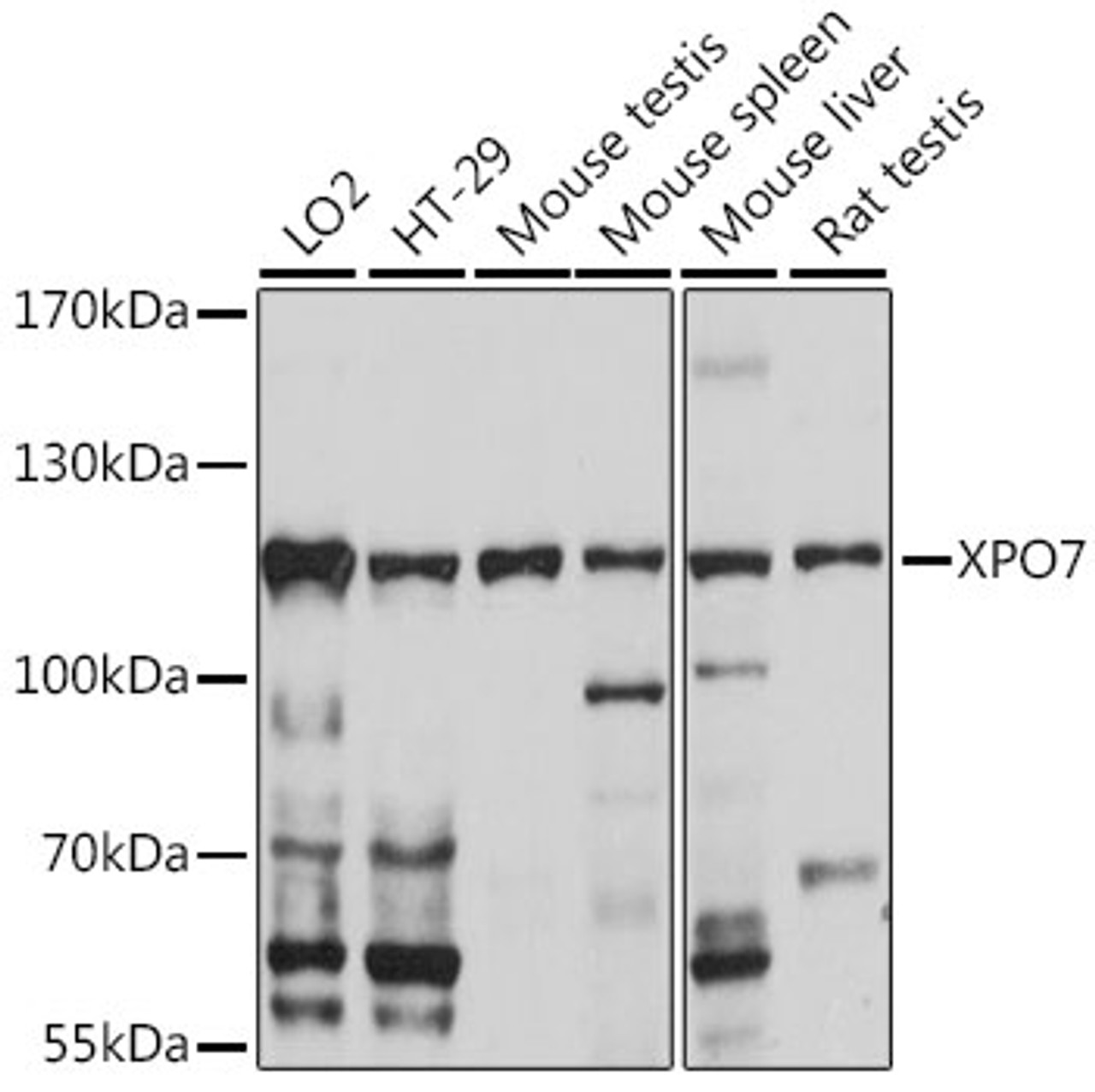 Western blot analysis of extracts of various cell lines, using XPO7 antibody (16-433) at 1:1000 dilution.<br/>Secondary antibody: HRP Goat Anti-Rabbit IgG (H+L) at 1:10000 dilution.<br/>Lysates/proteins: 25ug per lane.<br/>Blocking buffer: 3% nonfat dry milk in TBST.<br/>Detection: ECL Basic Kit.<br/>Exposure time: 10s.