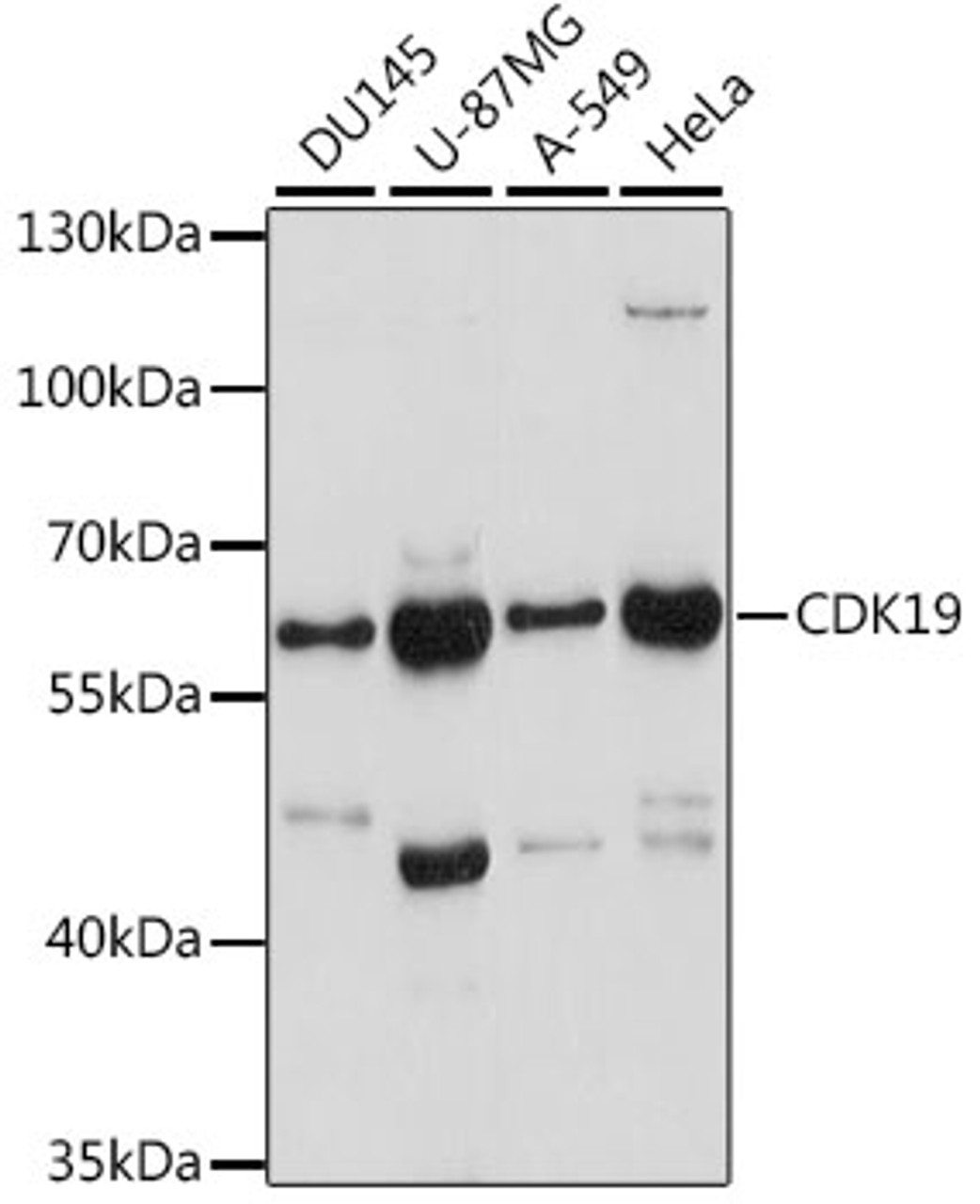 Western blot analysis of extracts of various cell lines, using CDK19 antibody (16-434) at 1:1000 dilution.<br/>Secondary antibody: HRP Goat Anti-Rabbit IgG (H+L) at 1:10000 dilution.<br/>Lysates/proteins: 25ug per lane.<br/>Blocking buffer: 3% nonfat dry milk in TBST.<br/>Detection: ECL Basic Kit.<br/>Exposure time: 60s.