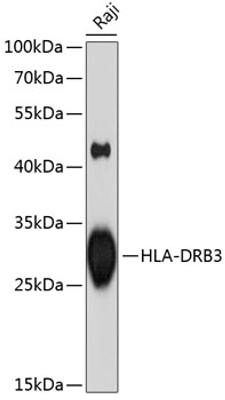 Western blot analysis of extracts of Raji cells, using HLA-DRB3 antibody (16-435) at 1:1000 dilution.<br/>Secondary antibody: HRP Goat Anti-Rabbit IgG (H+L) at 1:10000 dilution.<br/>Lysates/proteins: 25ug per lane.<br/>Blocking buffer: 3% nonfat dry milk in TBST.<br/>Detection: ECL Enhanced Kit.<br/>Exposure time: 90s.