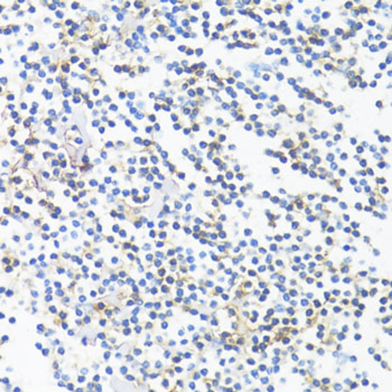 Immunohistochemistry of paraffin-embedded tonsil using HLA-DRB3 antibody (16-435) at dilution of 1:100 (40x lens) .