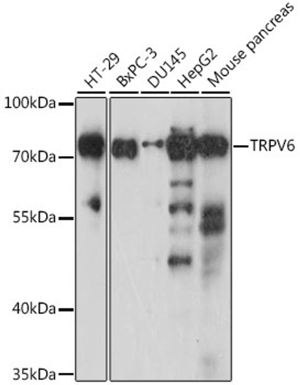 Western blot analysis of extracts of various cell lines, using TRPV6 antibody (16-447) at 1:1000 dilution.<br/>Secondary antibody: HRP Goat Anti-Rabbit IgG (H+L) at 1:10000 dilution.<br/>Lysates/proteins: 25ug per lane.<br/>Blocking buffer: 3% nonfat dry milk in TBST.<br/>Detection: ECL Basic Kit.<br/>Exposure time: 30s.