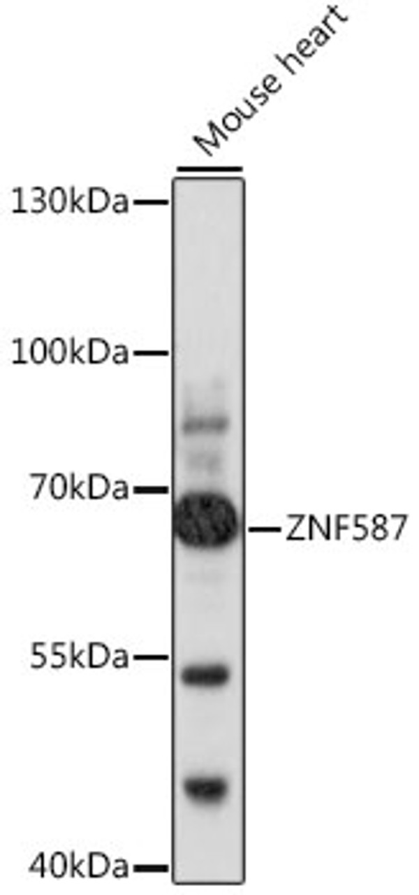 Western blot analysis of extracts of mouse heart, using ZNF587 antibody (16-460) at 1:1000 dilution.<br/>Secondary antibody: HRP Goat Anti-Rabbit IgG (H+L) at 1:10000 dilution.<br/>Lysates/proteins: 25ug per lane.<br/>Blocking buffer: 3% nonfat dry milk in TBST.<br/>Detection: ECL Basic Kit.<br/>Exposure time: 1s.