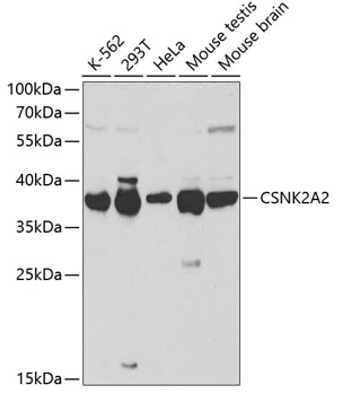 Western blot analysis of extracts of various cell lines, using CSNK2A2 antibody (16-463) at 1:1000 dilution.<br/>Secondary antibody: HRP Goat Anti-Rabbit IgG (H+L) at 1:10000 dilution.<br/>Lysates/proteins: 25ug per lane.<br/>Blocking buffer: 3% nonfat dry milk in TBST.