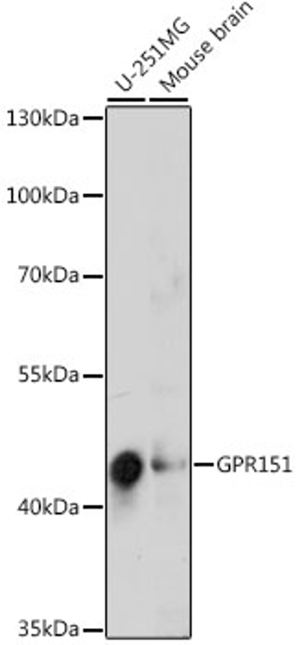 Western blot analysis of extracts of various cell lines, using GPR151 antibody (16-468) at 1:1000 dilution.<br/>Secondary antibody: HRP Goat Anti-Rabbit IgG (H+L) at 1:10000 dilution.<br/>Lysates/proteins: 25ug per lane.<br/>Blocking buffer: 3% nonfat dry milk in TBST.<br/>Detection: ECL Basic Kit.<br/>Exposure time: 90s.