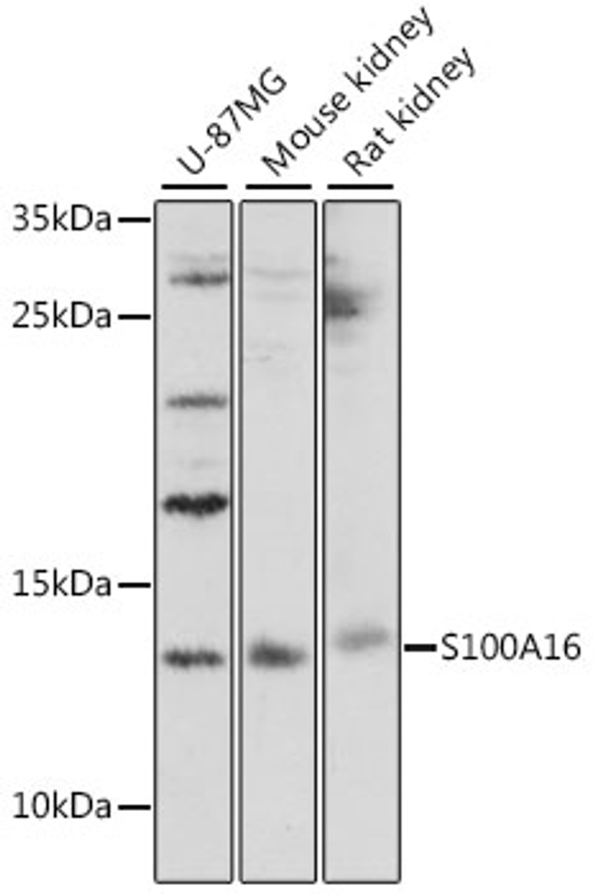 Western blot analysis of extracts of various cell lines, using S100A16 antibody (16-470) at 1:1000 dilution.<br/>Secondary antibody: HRP Goat Anti-Rabbit IgG (H+L) at 1:10000 dilution.<br/>Lysates/proteins: 25ug per lane.<br/>Blocking buffer: 3% nonfat dry milk in TBST.<br/>Detection: ECL Basic Kit.<br/>Exposure time: 90s.