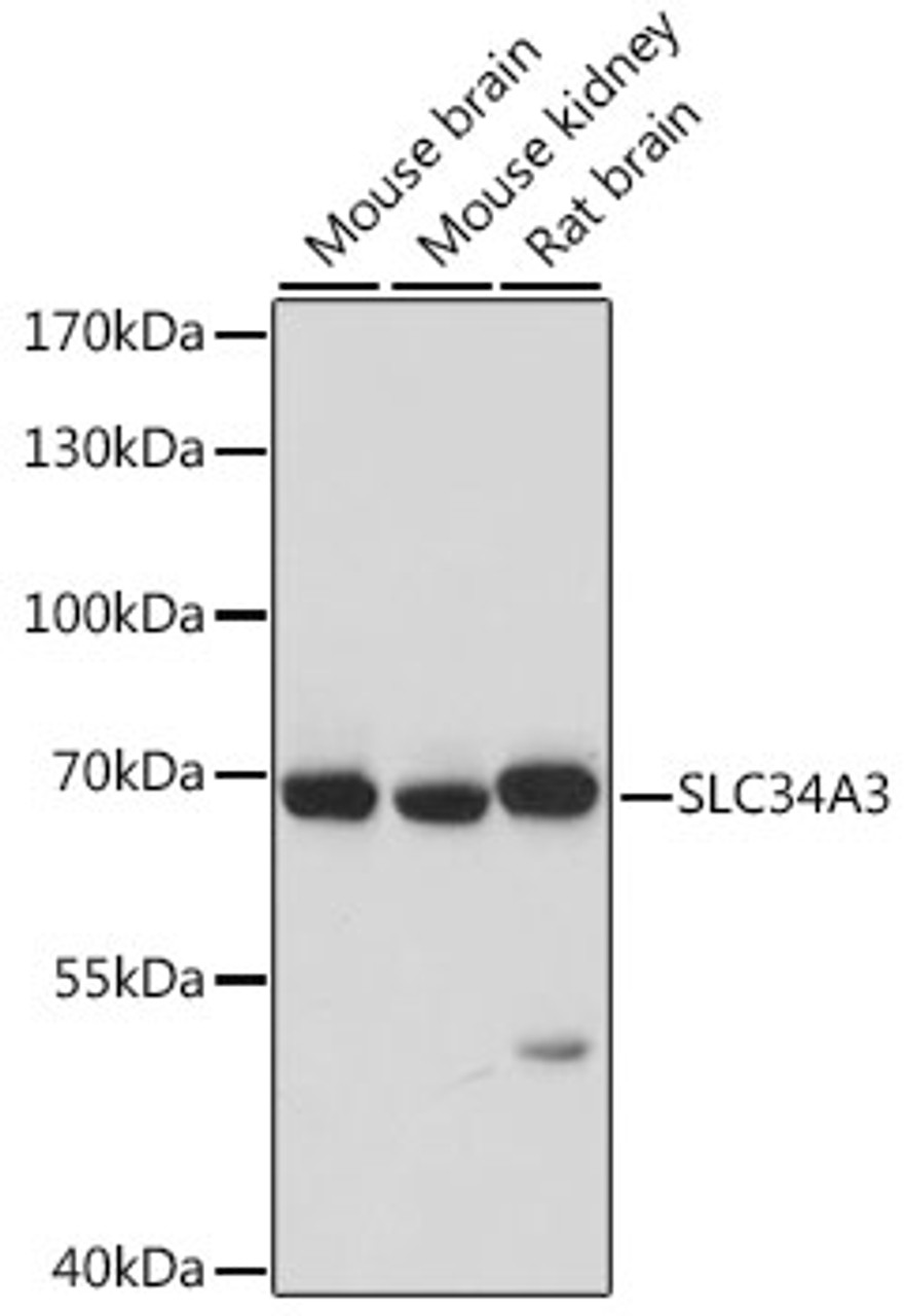 Western blot analysis of extracts of various cell lines, using SLC34A3 antibody (16-471) at 1:1000 dilution.<br/>Secondary antibody: HRP Goat Anti-Rabbit IgG (H+L) at 1:10000 dilution.<br/>Lysates/proteins: 25ug per lane.<br/>Blocking buffer: 3% nonfat dry milk in TBST.<br/>Detection: ECL Basic Kit.<br/>Exposure time: 10s.