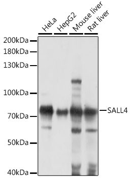 Western blot analysis of extracts of various cell lines, using SALL4 antibody (16-485) at 1:1000 dilution.<br/>Secondary antibody: HRP Goat Anti-Rabbit IgG (H+L) at 1:10000 dilution.<br/>Lysates/proteins: 25ug per lane.<br/>Blocking buffer: 3% nonfat dry milk in TBST.<br/>Detection: ECL Basic Kit.<br/>Exposure time: 30s.