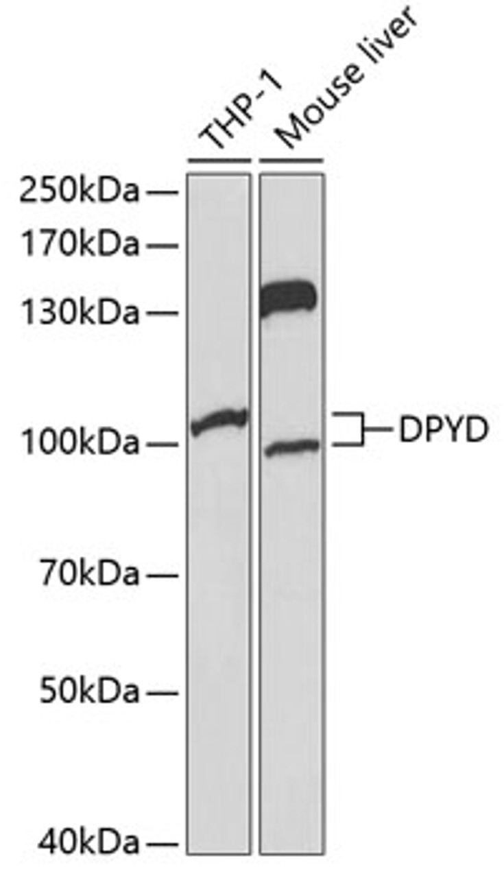 Western blot analysis of extracts of various cell lines, using DPYD Antibody (16-487) at 1:1000 dilution.<br/>Secondary antibody: HRP Goat Anti-Rabbit IgG (H+L) at 1:10000 dilution.<br/>Lysates/proteins: 25ug per lane.<br/>Blocking buffer: 3% nonfat dry milk in TBST.<br/>Detection: ECL Basic Kit.