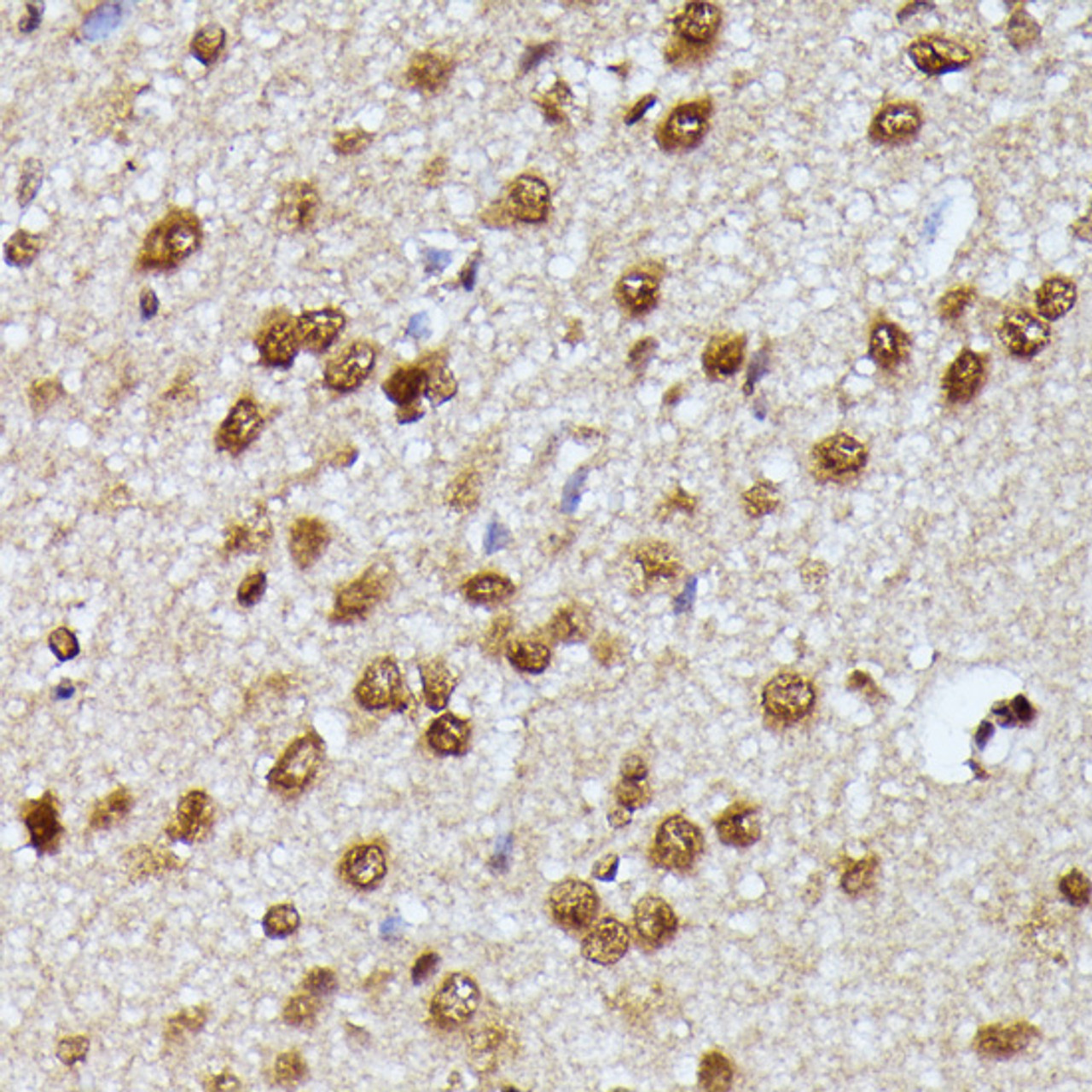 Immunohistochemistry of paraffin-embedded rat brain using KIAA1429 antibody (16-489) at dilution of 1:100 (40x lens) .