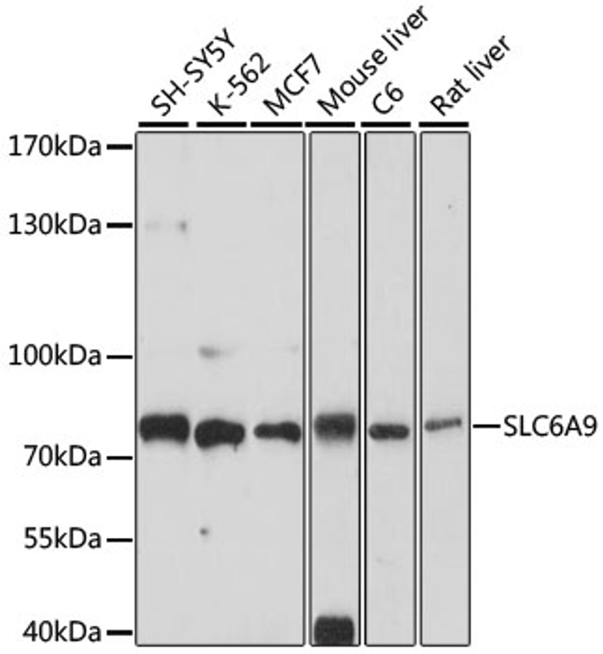 Western blot analysis of extracts of various cell lines, using SLC6A9 antibody (16-490) at 1:1000 dilution.<br/>Secondary antibody: HRP Goat Anti-Rabbit IgG (H+L) at 1:10000 dilution.<br/>Lysates/proteins: 25ug per lane.<br/>Blocking buffer: 3% nonfat dry milk in TBST.<br/>Detection: ECL Basic Kit.<br/>Exposure time: 10s.