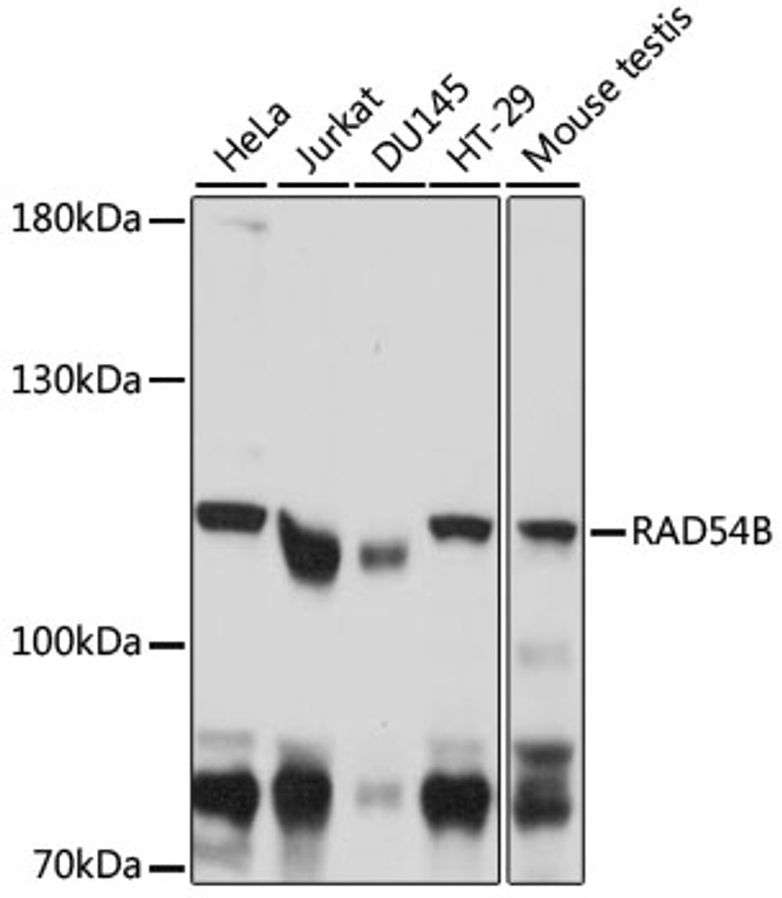 Western blot analysis of extracts of various cell lines, using RAD54B antibody (16-491) at 1:1000 dilution.<br/>Secondary antibody: HRP Goat Anti-Rabbit IgG (H+L) at 1:10000 dilution.<br/>Lysates/proteins: 25ug per lane.<br/>Blocking buffer: 3% nonfat dry milk in TBST.<br/>Detection: ECL Basic Kit.<br/>Exposure time: 5s.