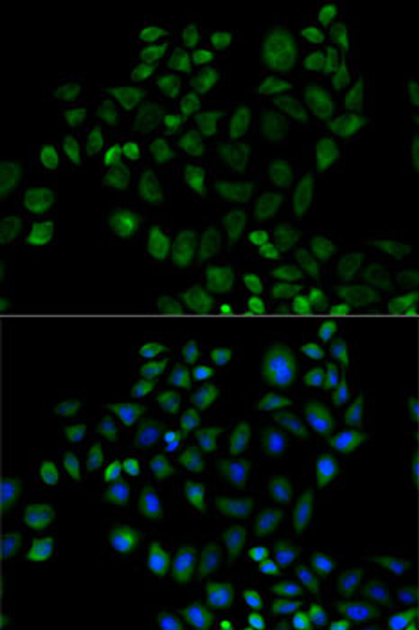 Immunofluorescence analysis of HeLa cells using FABP2 antibody (16-492) . Blue: DAPI for nuclear staining.