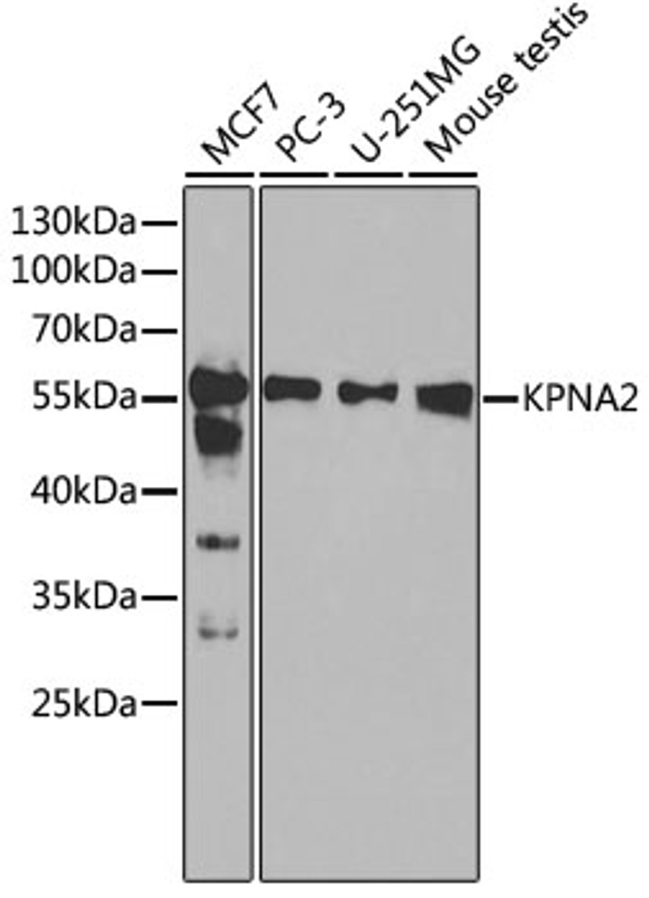 Western blot analysis of extracts of various cell lines, using KPNA2 antibody (16-503) at 1:1000 dilution.<br/>Secondary antibody: HRP Goat Anti-Rabbit IgG (H+L) at 1:10000 dilution.<br/>Lysates/proteins: 25ug per lane.<br/>Blocking buffer: 3% nonfat dry milk in TBST.