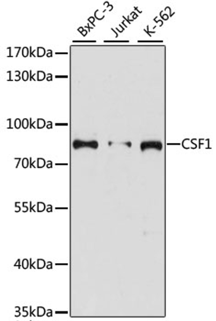Western blot analysis of extracts of various cell lines, using CSF1 antibody (16-516) at 1:3000 dilution.<br/>Secondary antibody: HRP Goat Anti-Rabbit IgG (H+L) at 1:10000 dilution.<br/>Lysates/proteins: 25ug per lane.<br/>Blocking buffer: 3% nonfat dry milk in TBST.<br/>Detection: ECL Basic Kit.<br/>Exposure time: 90s.