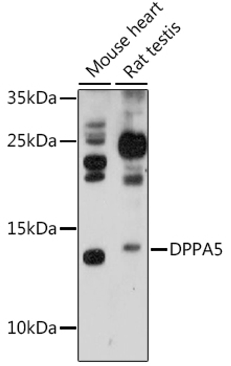 Western blot analysis of extracts of various cell lines, using DPPA5 antibody (16-523) at 1:1000 dilution.<br/>Secondary antibody: HRP Goat Anti-Rabbit IgG (H+L) at 1:10000 dilution.<br/>Lysates/proteins: 25ug per lane.<br/>Blocking buffer: 3% nonfat dry milk in TBST.<br/>Detection: ECL Basic Kit.<br/>Exposure time: 3min.