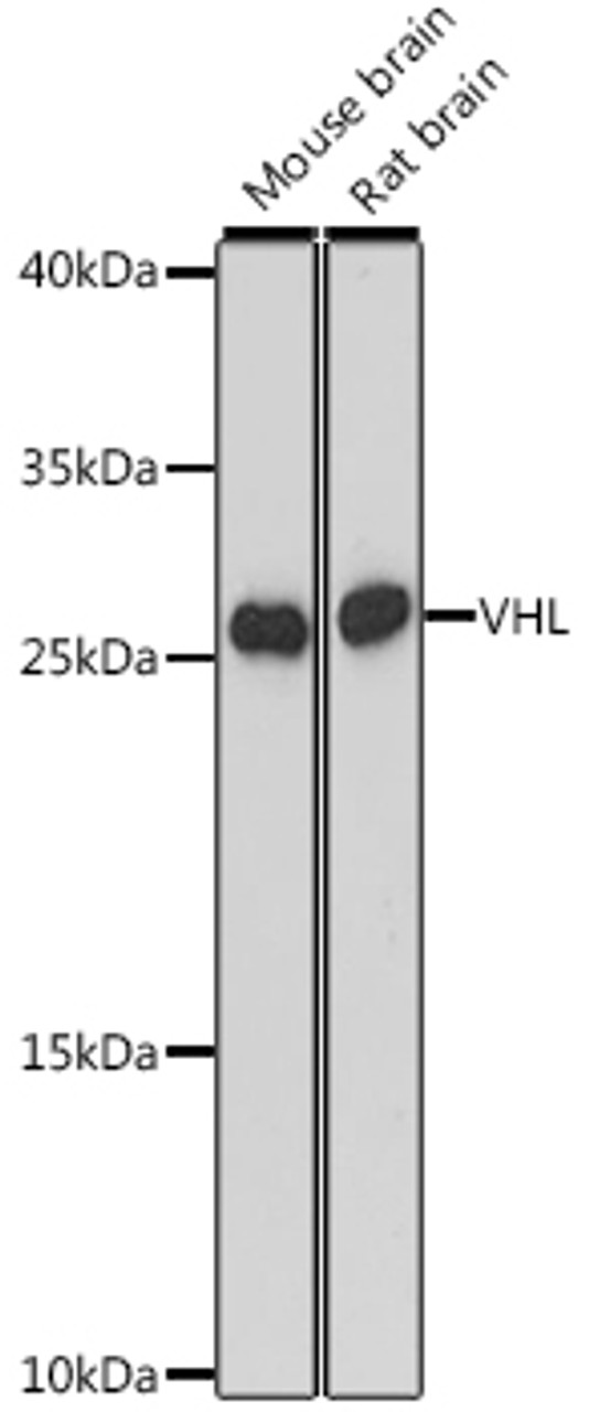 Western blot analysis of extracts of various cell lines, using VHL antibody (16-528) at 1:3000 dilution.<br/>Secondary antibody: HRP Goat Anti-Rabbit IgG (H+L) at 1:10000 dilution.<br/>Lysates/proteins: 25ug per lane.<br/>Blocking buffer: 3% nonfat dry milk in TBST.<br/>Detection: ECL Basic Kit.<br/>Exposure time: 90s.