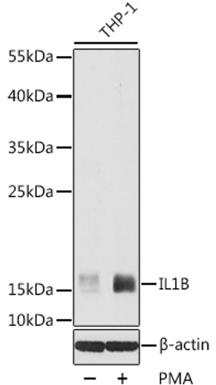 Western blot analysis of extracts of THP-1 cells, using IL1B antibody (16-529) at 1:1000 dilution. THP-1 cells were treated by PMA (80 nM) at 37℃ for overnight.<br/>Secondary antibody: HRP Goat Anti-Rabbit IgG (H+L) at 1:10000 dilution.<br/>Lysates/proteins: 25ug per lane.<br/>Blocking buffer: 3% nonfat dry milk in TBST.<br/>Detection: ECL Basic Kit.<br/>Exposure time: 3s.