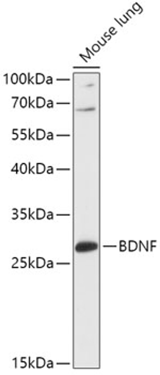 Western blot analysis of extracts of Mouse lung, using BDNF antibody (16-533) at 1:1000 dilution.<br/>Secondary antibody: HRP Goat Anti-Rabbit IgG (H+L) at 1:10000 dilution.<br/>Lysates/proteins: 25ug per lane.<br/>Blocking buffer: 3% nonfat dry milk in TBST.<br/>Detection: ECL Basic Kit.<br/>Exposure time: 60s.