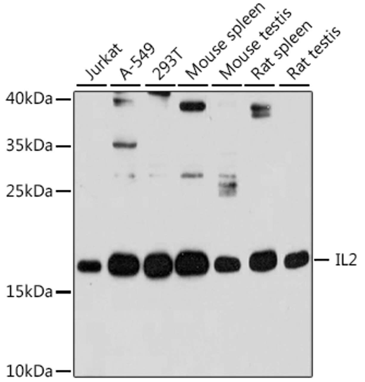 Western blot analysis of extracts of various cell lines, using IL2 antibody (16-547) at 1:1000 dilution.<br/>Secondary antibody: HRP Goat Anti-Rabbit IgG (H+L) at 1:10000 dilution.<br/>Lysates/proteins: 25ug per lane.<br/>Blocking buffer: 3% nonfat dry milk in TBST.<br/>Detection: ECL Basic Kit.<br/>Exposure time: 30s.